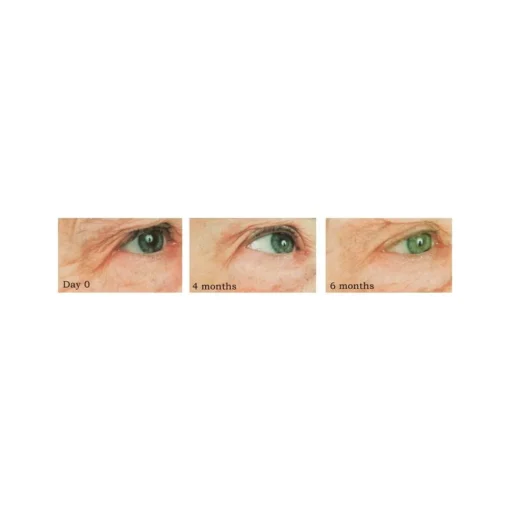 Repêchage - Vita Cura® Triple Firming Cream - Professional Cosmetics - Avvenice